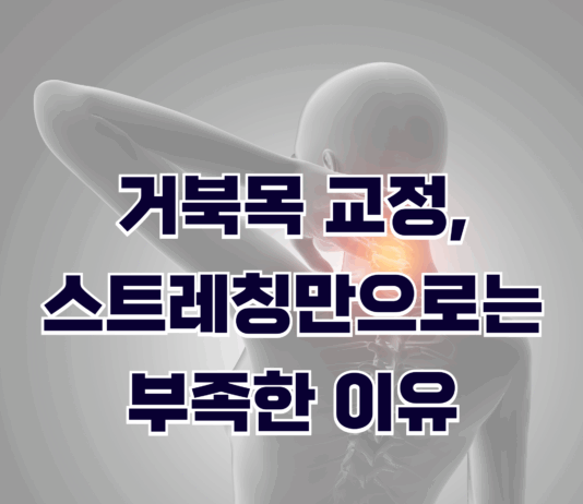 거북목 교정, 스트레칭만으로는 부족한 이유